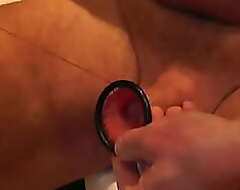 Black ring at my foreskin